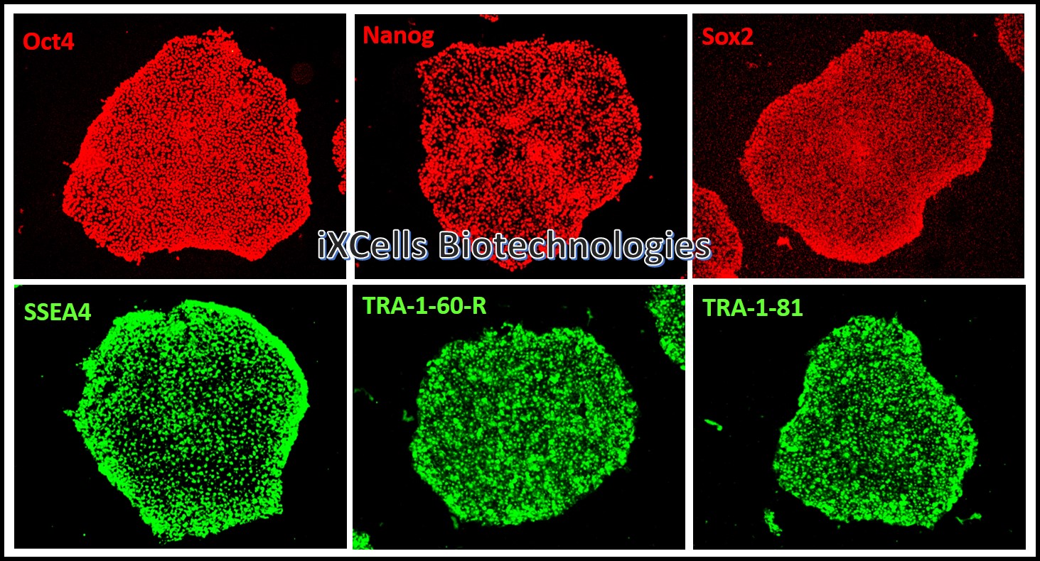 Human iPSC markers